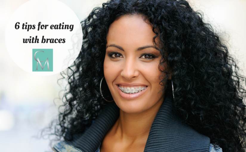 6 Tips for Eating with Braces - Chingford Mount Dental Practice