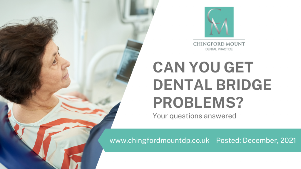 Can You Get Dental Bridge Problems?