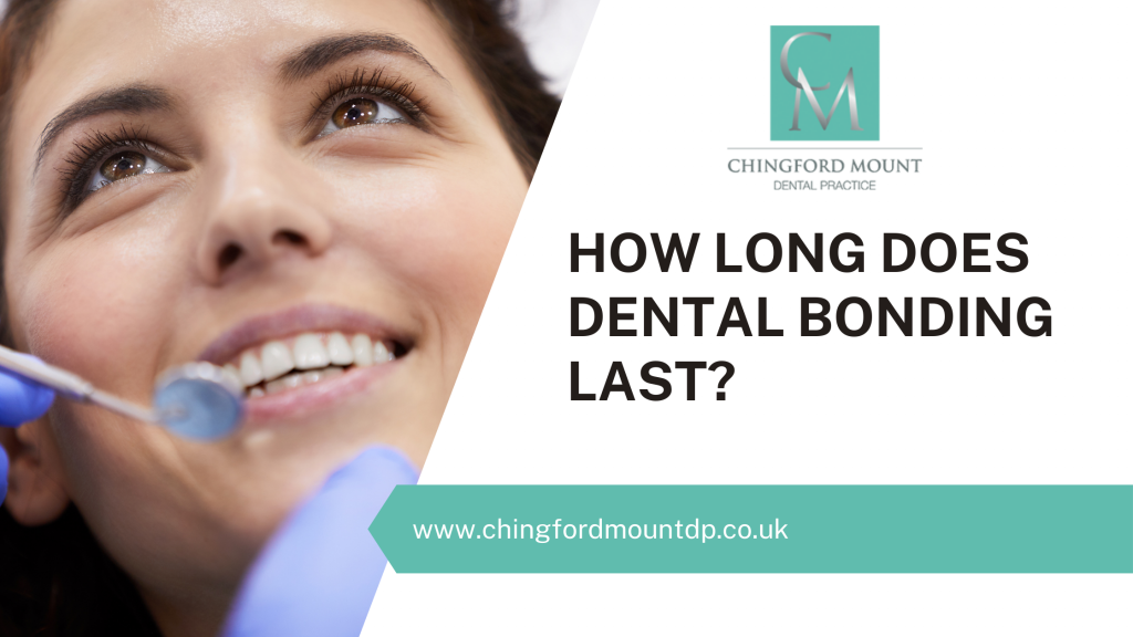 How Long Does Dental Bonding Last?