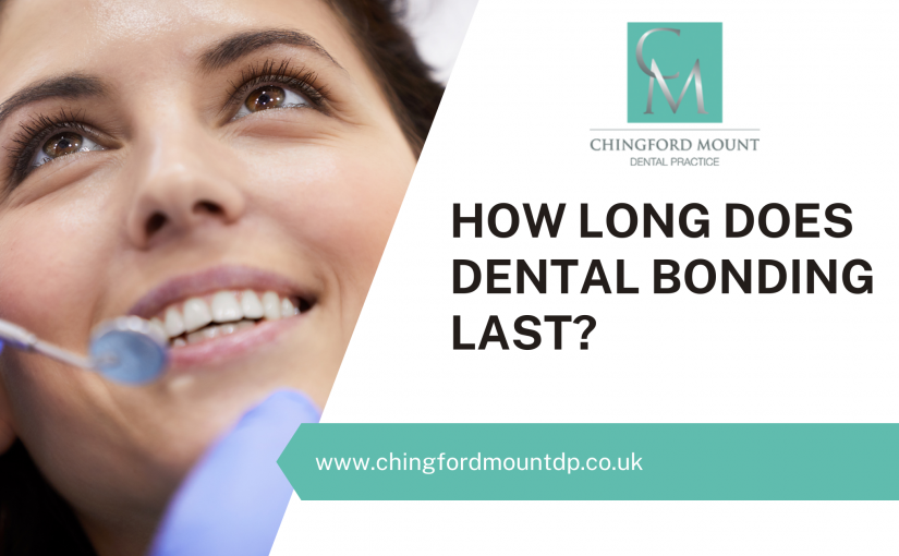 How Long Does Dental Bonding Last?