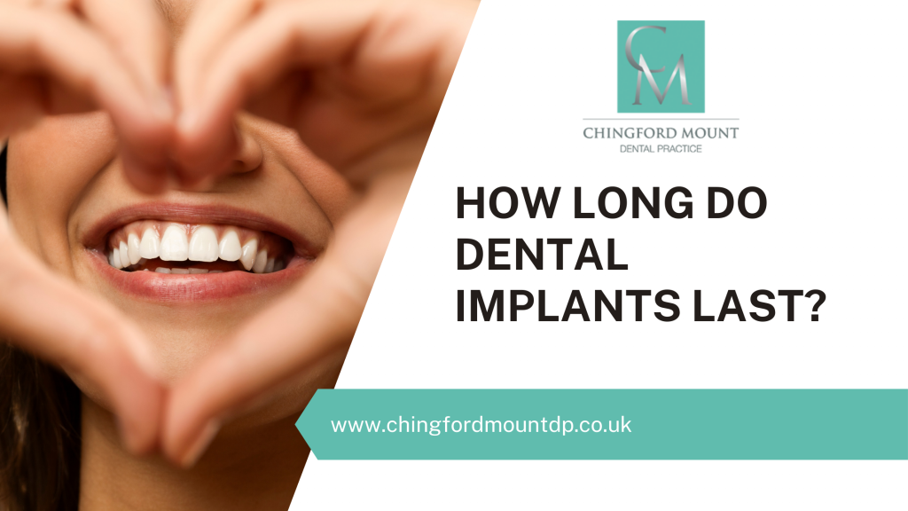 How long do dental implants last?