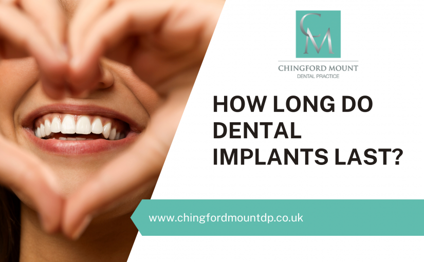 How long do dental implants last?