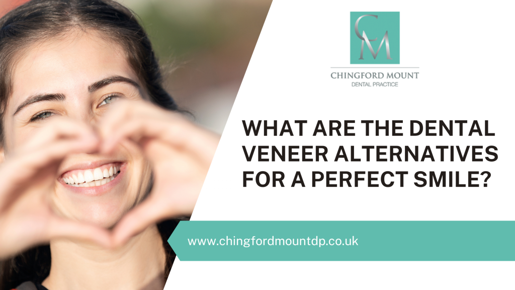 What Are The Dental Veneer Alternatives For A Perfect Smile?