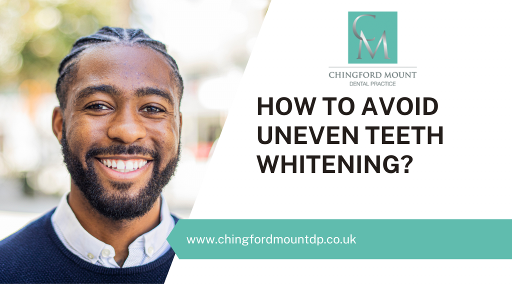 How to avoid uneven teeth whitening?